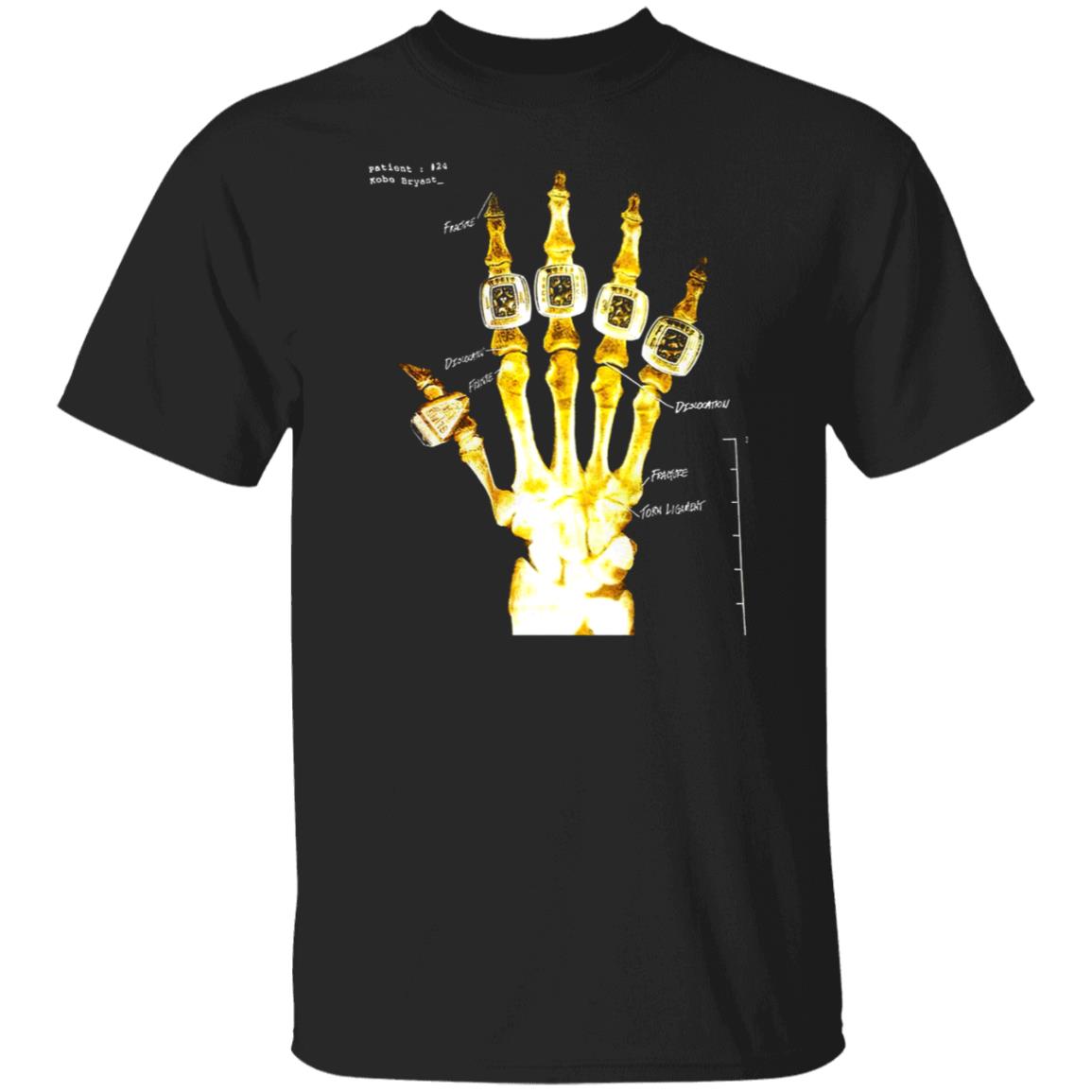 kobe broken hand shirt
